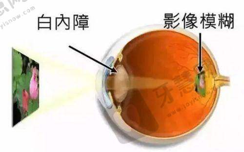上海海军军 医 大学附属第一医院眼科详细的预约挂号方式及流程