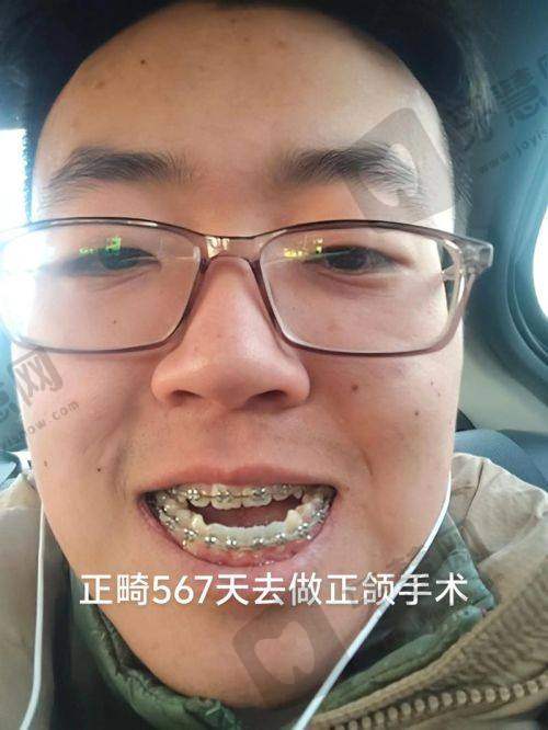 上海时光整形何晋龙医生技术优势