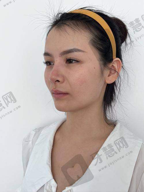 杭州浮想国熊哲祯医生预约挂号