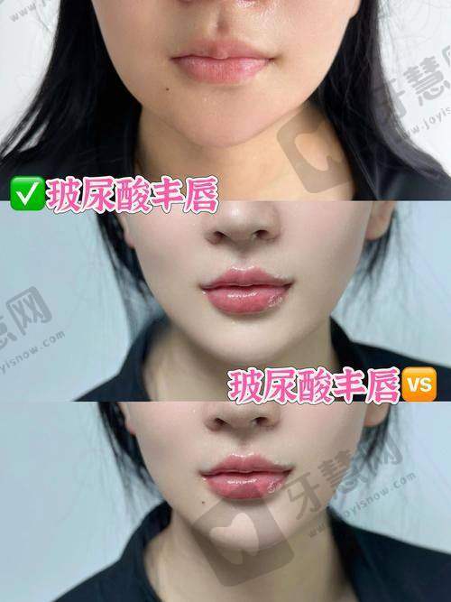 杭州浮想国熊哲祯医生技术优势