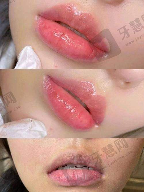 蒋铮铮医生技术优势