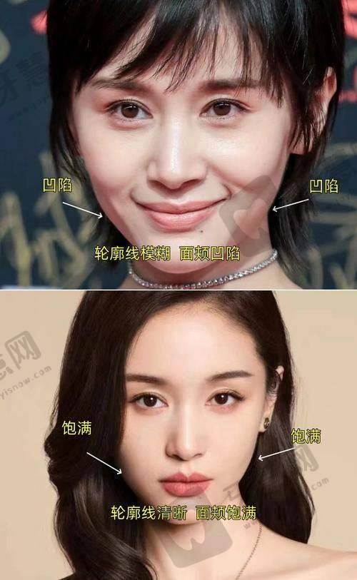 南昌柠檬一美医疗美容医院特色项目及技术优势