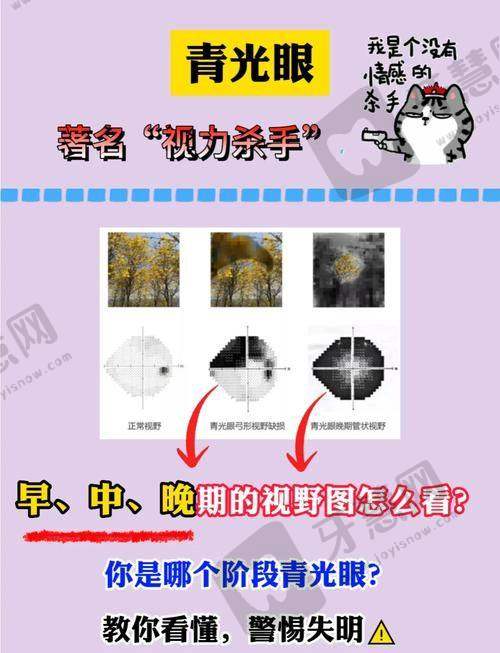 长春华正眼科医院特色项目及技术优势