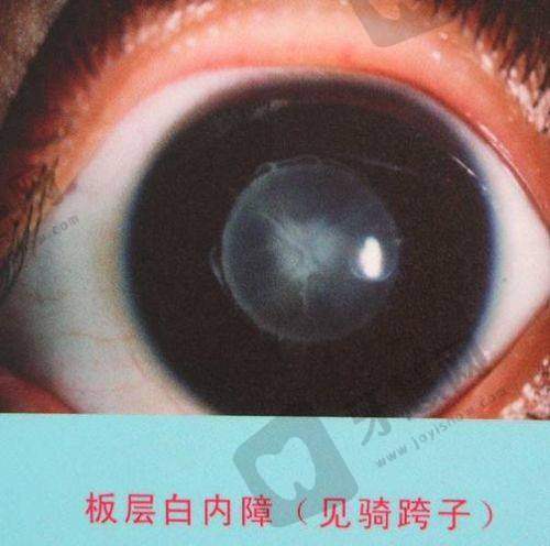 上海至臻视界眼科(浦东店)地址电话营业时间