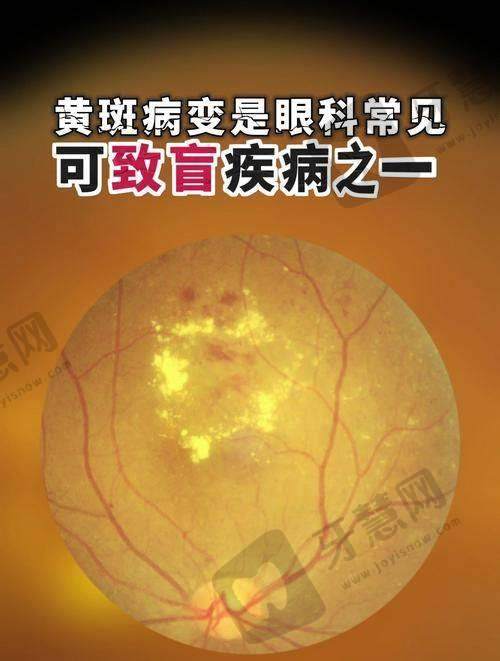 上海爱尔眼科医院（总院）特色项目及技术优势