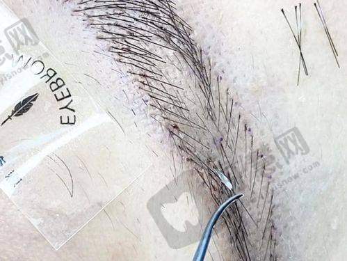 邯郸张小熊医疗美容门诊部真人口碑评价怎么样？