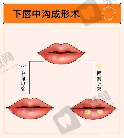 上海华艺星整形郭敬松医生技术优势