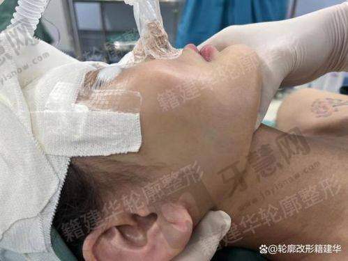 济南星氧医疗美容门诊部特色项目及技术优势