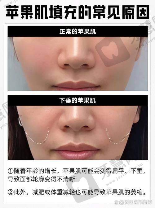 太原排行榜前十的乔雅登玻尿酸医院名单揭秘：2025太原整形美容医院排名前十位打玻尿酸技术强、口碑佳，塑形自然效果好
