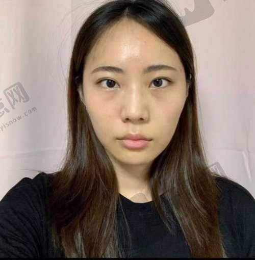 4、太原市中 心医院整形美容科
