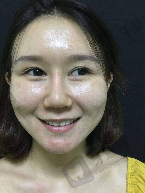 济南丽合医疗美容医院详细的预约挂号方式及流程