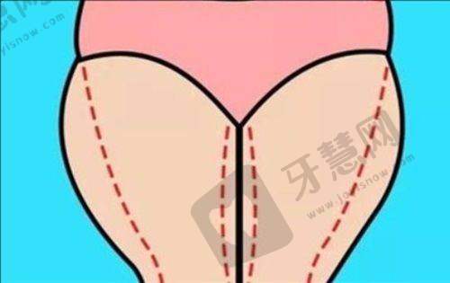 泉州欧菲医疗美容门诊部