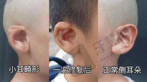 想了解男性去势手术？2025手术流程、副作用及北京协和医院案例全揭秘