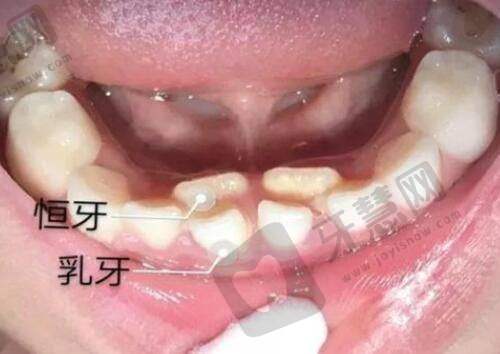 南宁碧莲盛植发医院