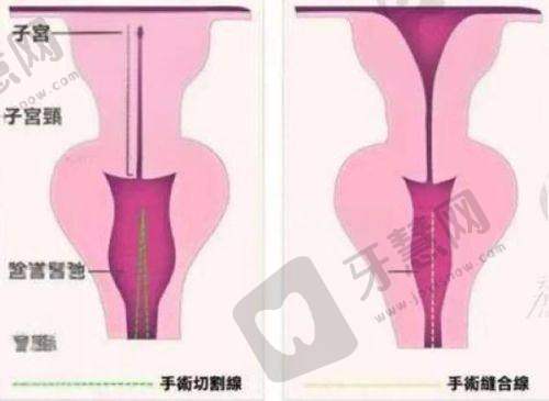 南宁珍善美医疗美容诊所收费价格表：