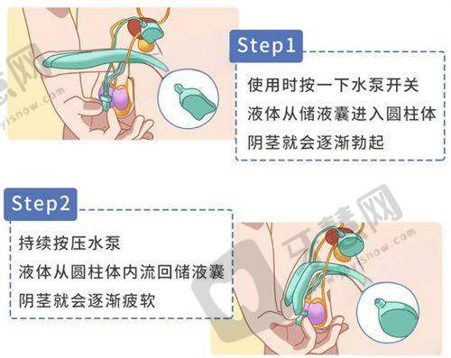 24小时男科免费询问:李世荣医生手术价格与成效维持时间