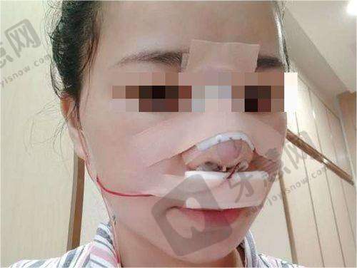 普宁安琪医院其他整形项目及优势