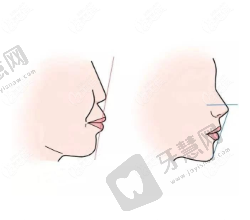 泉州众乘口腔门诊部收费价格表：