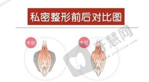 南宁贞韩植发医院正规吗？