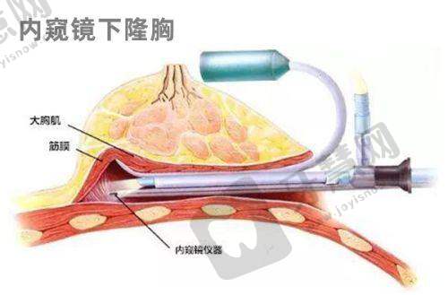 长沙健丽美诗沁医疗美容门诊部正规吗？