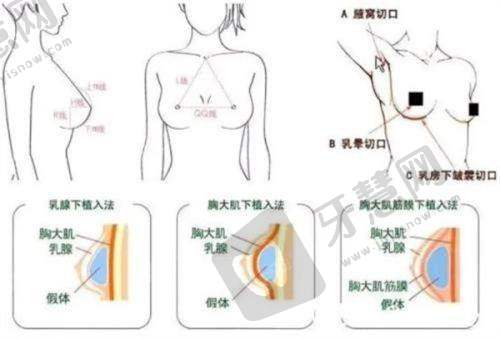 深圳阳光医院是三等甲医院吗