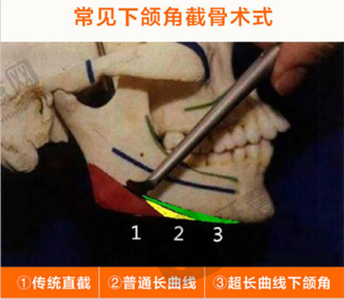 男科医院排名更好的医院之韩国正规男科医院