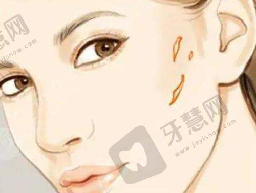 男科假体植入多少钱？上海九龙医院18万起，患者术后满意度高可预约