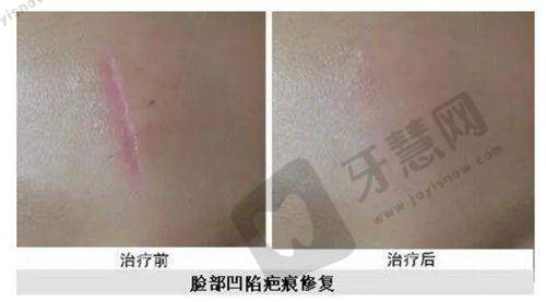 南宁健丽美诗沁医疗美容门诊部正规吗？