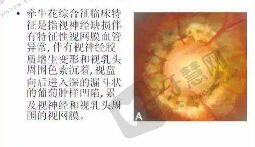 上海艾嘉瞳心眼科收费价格表：全飞秒18000元起、ICL晶体植入32000元起