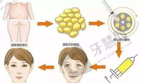 男科在线问诊免费:常见问题解答