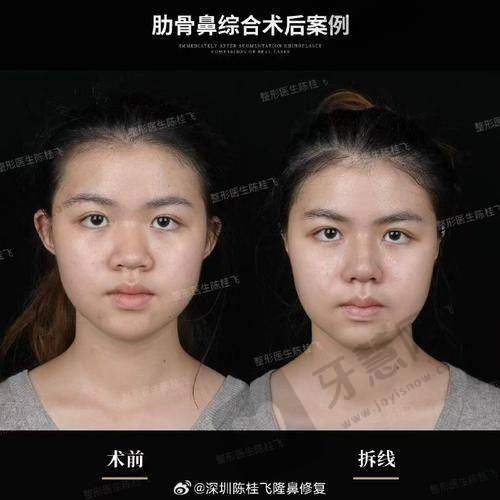 郝亚宁医生的口碑评价及反馈内容