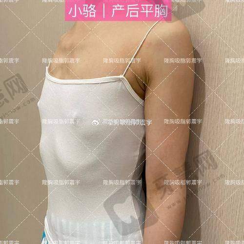 郝亚宁医生擅长的整形项目