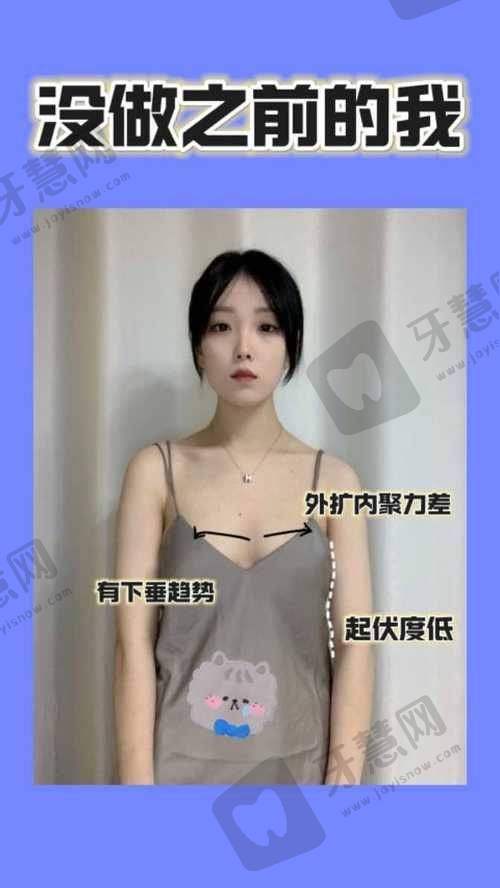 石亮医生的技术优势体现