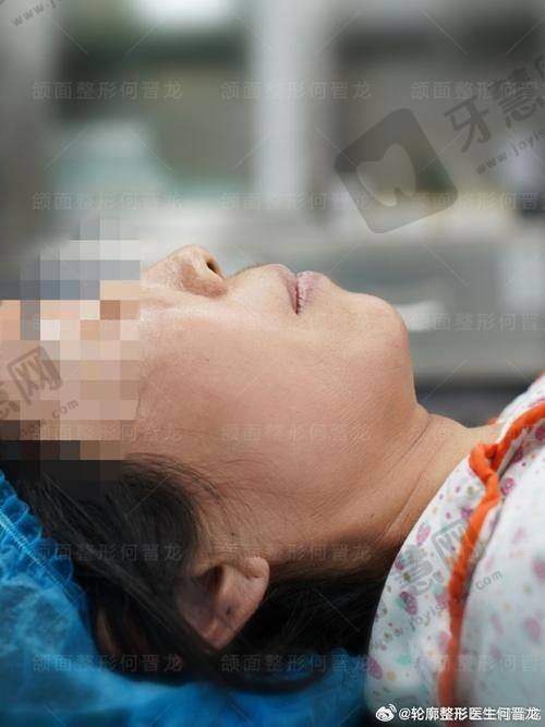 鲁峰医生的整形技术优势