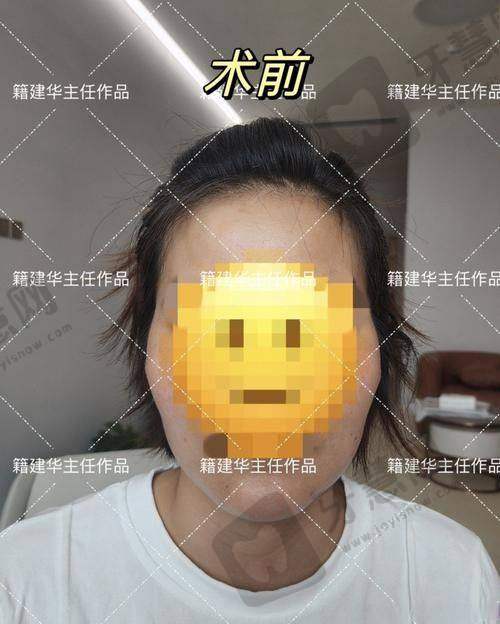 田鹏医生的技术优势亮点
