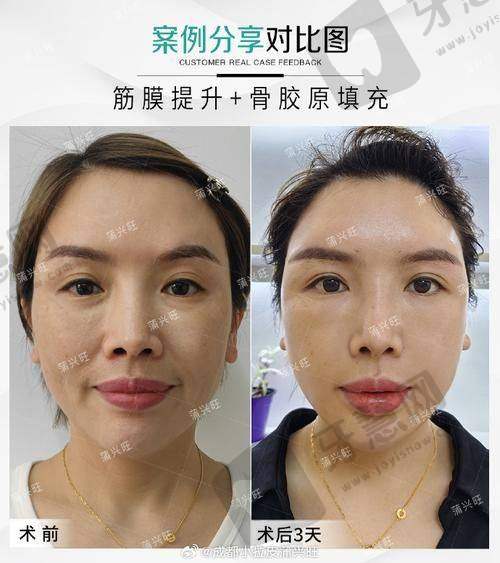 赵峻贤医生的技术优势亮点