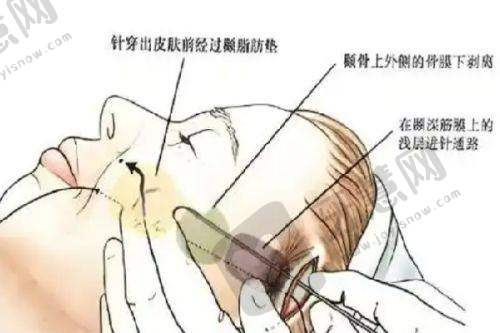 总结：重庆松山整形医院与朱乐林医生是值得信赖的选择