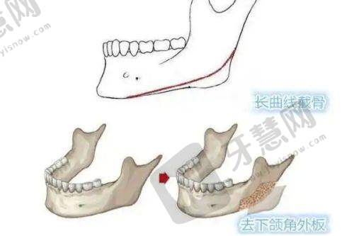 上海虹桥医院私密整形中 心优势分析