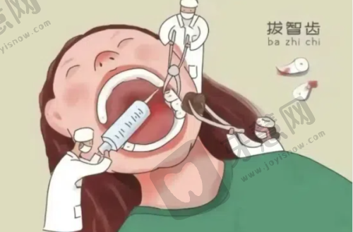 牙齿活动了更好的处理方法——种植牙技术与品牌:怎么选不踩坑?