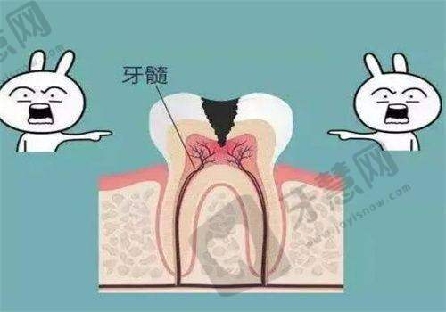 超薄全瓷贴面对齿有用吗？2025牙医揭秘：对龋齿有效吗、优缺点及危害分析！