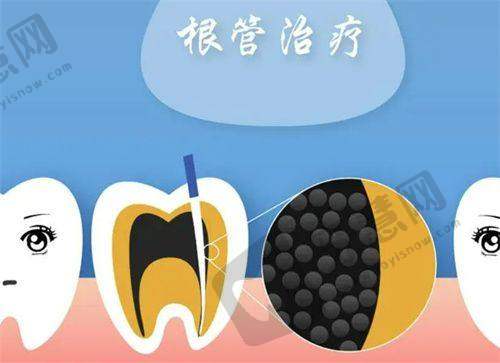 信号5：全身营养状况（“养料”不足）：缺钙、缺维生素，牙齿“长不牢”