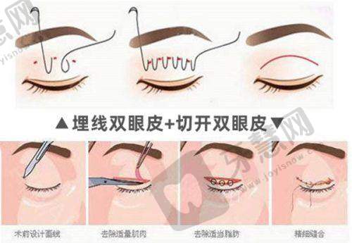 巫文云医生的技术优势