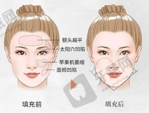 南昌同一济甄美医疗美容门诊部收费价格表/收费标准
