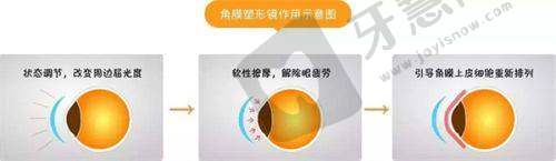 2025北京同仁医院眼科医生排名榜：朱晓青医生详细介绍