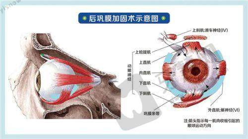 2025北京同仁医院眼科医生排名情况如何？邱礼新、马东丽、朱晓青等技术流医生上榜