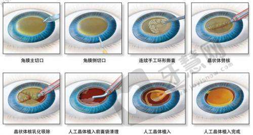 哈尔滨第二一一医院眼科医生简介