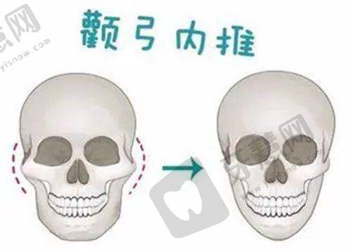 双眼皮整形项目介绍：星眸美眼术成特色亮点