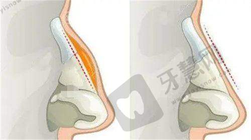 重点推荐：擅长眼部整形的“宝藏医生”刘军、王恒、史文君