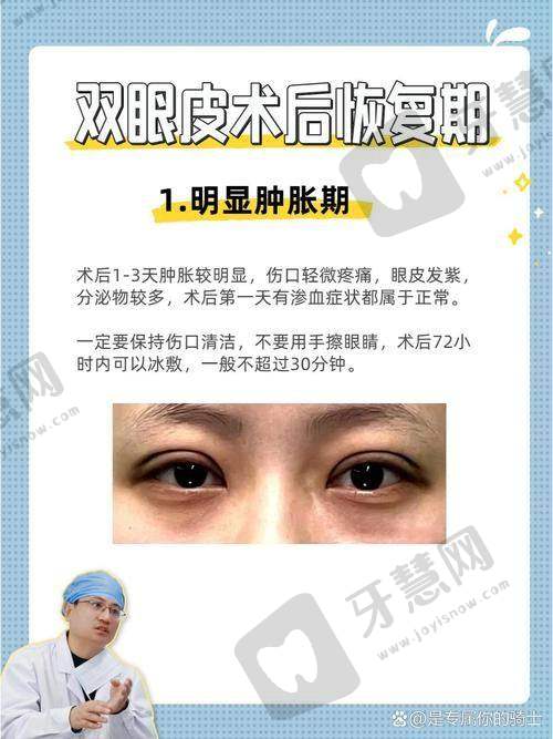 上海伯思立医疗美容医院双眼皮手术怎么样？沈国雄、徐晓斐、周珍艳用户评价揭秘