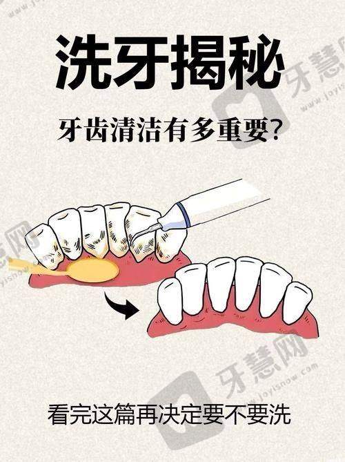 西诺德全瓷牙价格多少